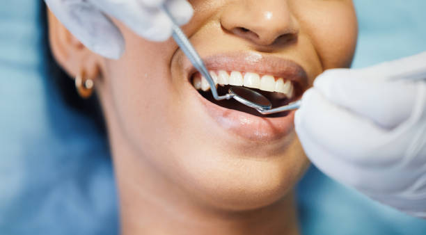 Best Emergency Dentist for Knocked-Out Tooth in Old Westbury, NY