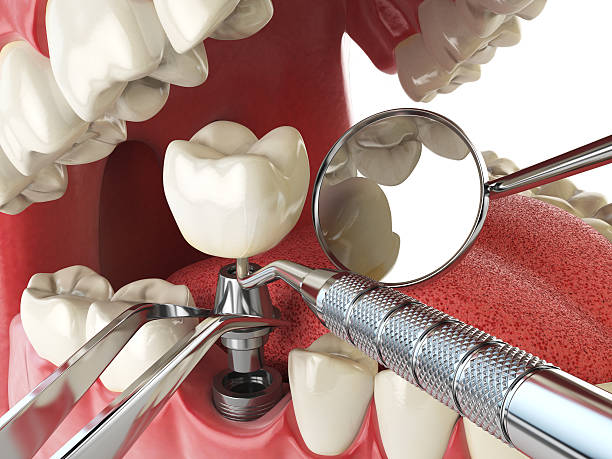 Best Emergency Dental Services for Seniors in Old Westbury, NY